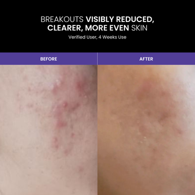 LUSTRE REVIVE LED Mask