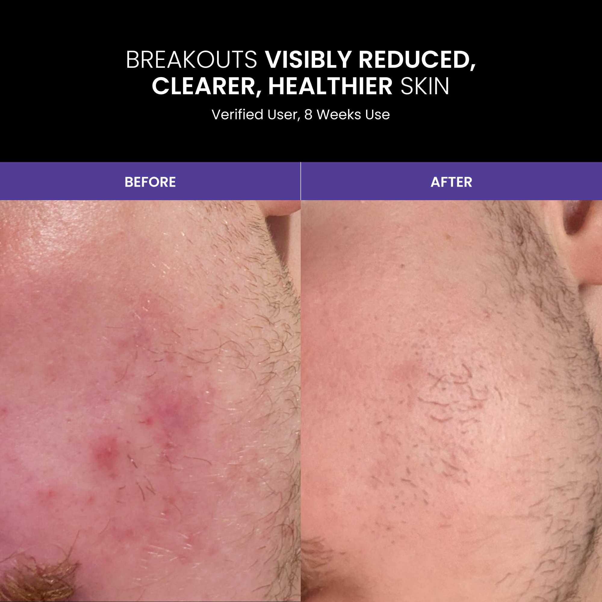LUSTRE RENEW PRO FACEWEAR