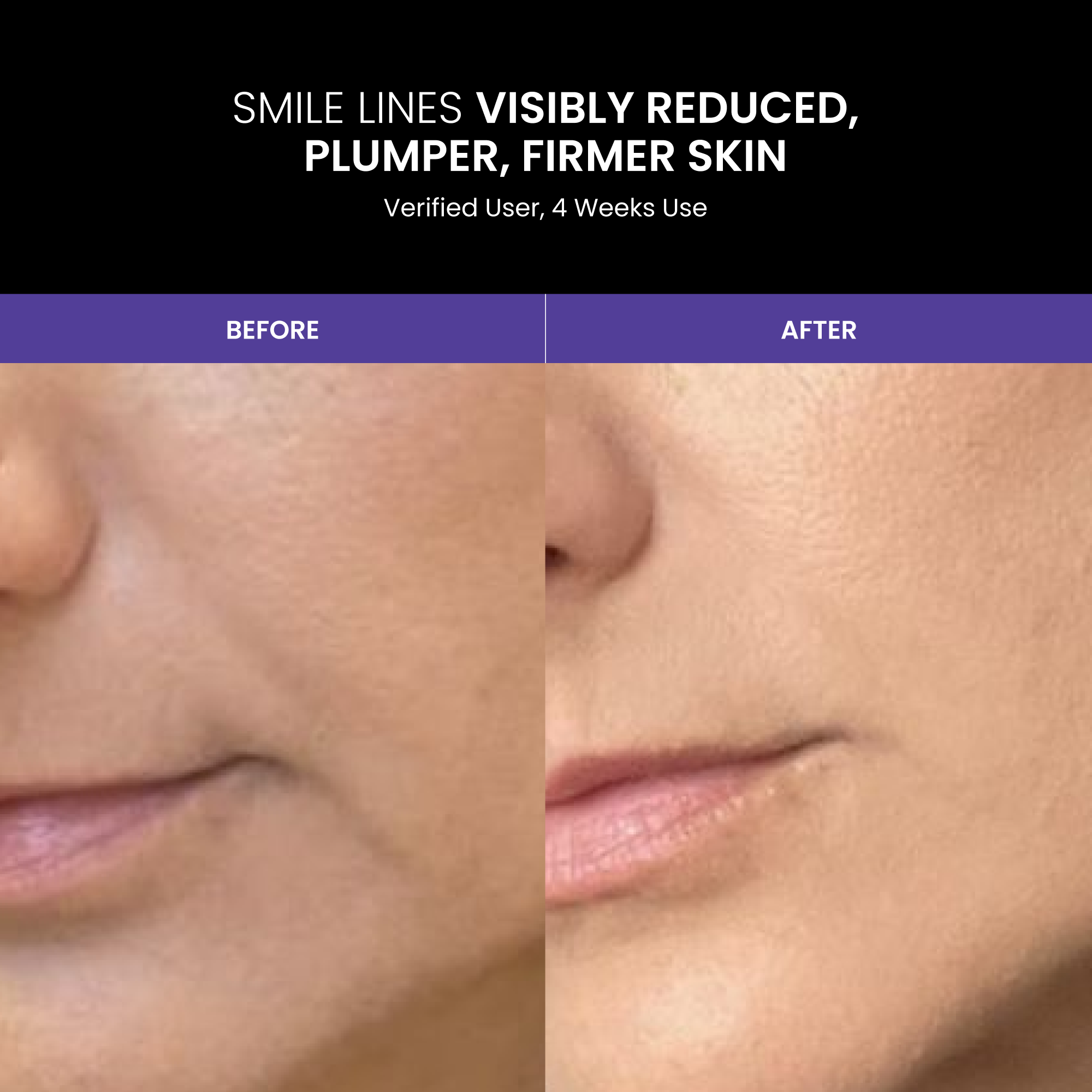 LUSTRE REVIVE LED Mask