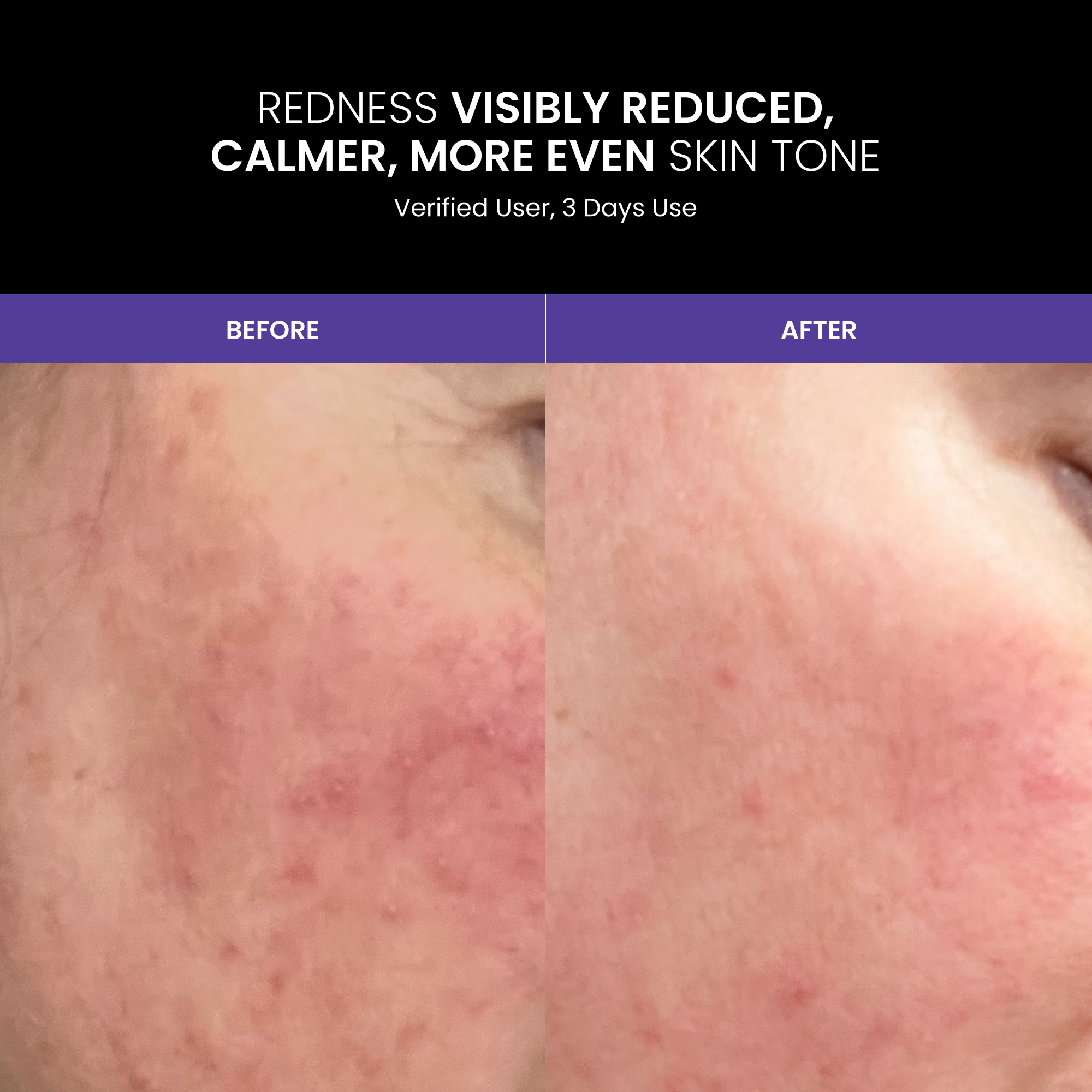 LUSTRE RENEW PRO FACEWEAR
