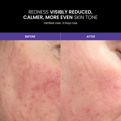 LUSTRE RENEW PRO FACEWEAR